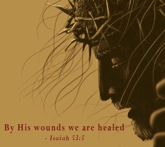 By His Wounds Ministry